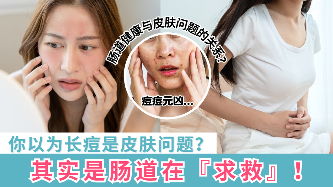 你以为长痘是皮肤问题?其实是肠道在『求救』!