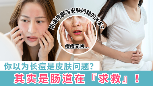 你以为长痘是皮肤问题?其实是肠道在『求救』!