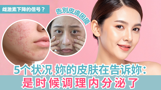 5个状况 妳的皮肤在告诉妳:是时候调理内分泌了